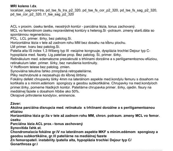 Čo mi zistili na MR kolena?