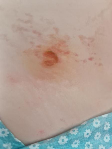 Čo to má 2-ročný syn na chrbte?