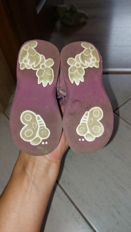 Sandalky protetika, protetika,20