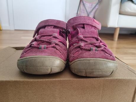 Protetika sandalky, protetika,32