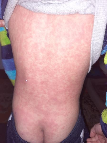 Syn mal kiahne a extrémne sa vysypal