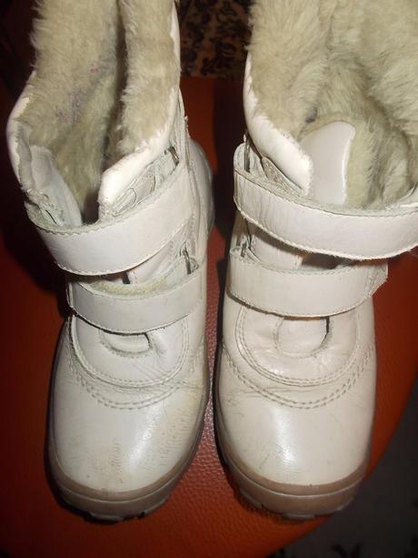 Topanky protetika, protetika,34