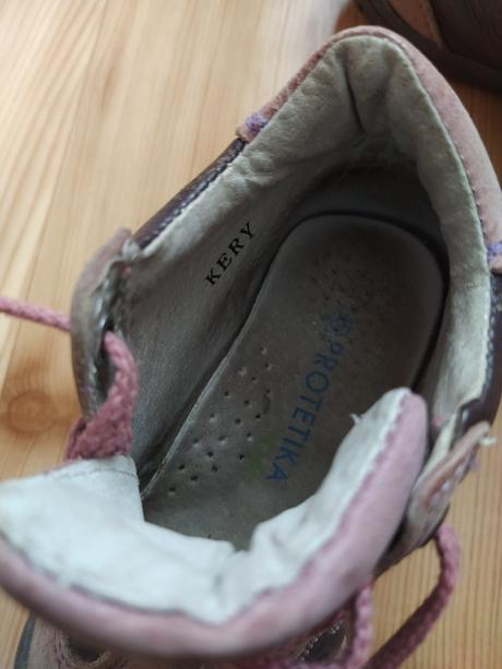 Dievcenske topanky protetika, protetika,22