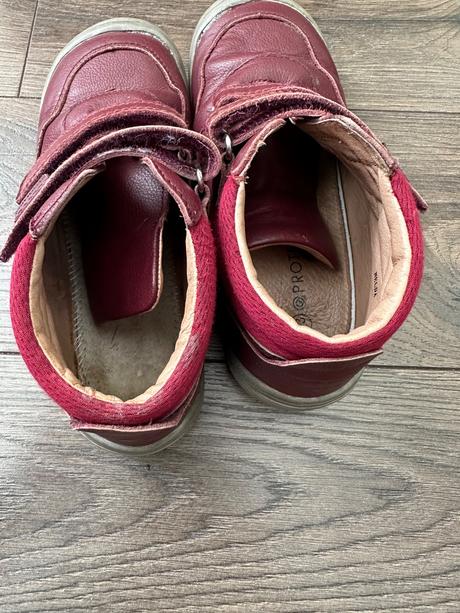 Protetika prechodné topánky, protetika,33