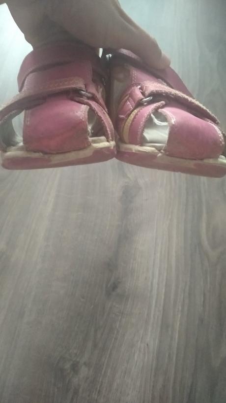 Sandále, protetika,31