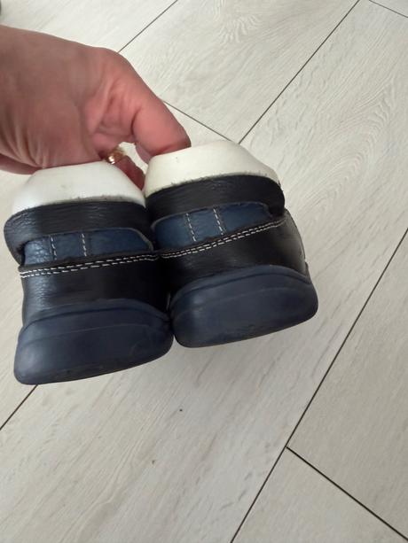 Protetika, protetika,33