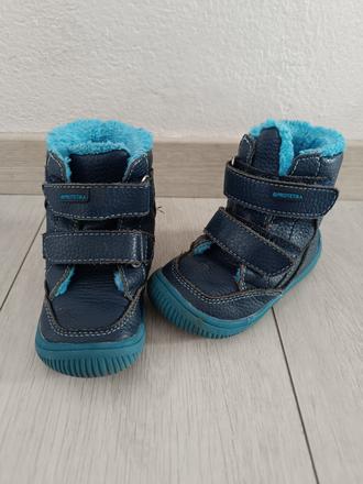 Protetika zimne barefoot, protetika,21