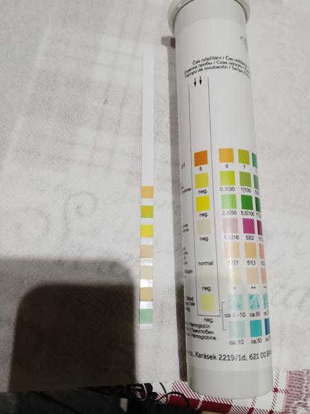 Ako si vysvetliť výsledky testu moču?