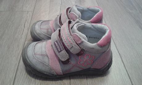 Prechodné topánky protetika, protetika,22