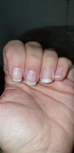 Ako upraviť nechty poškodené obhrýzaním ? 