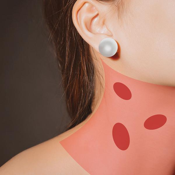 Krčná cysta, uzol alebo uzlina