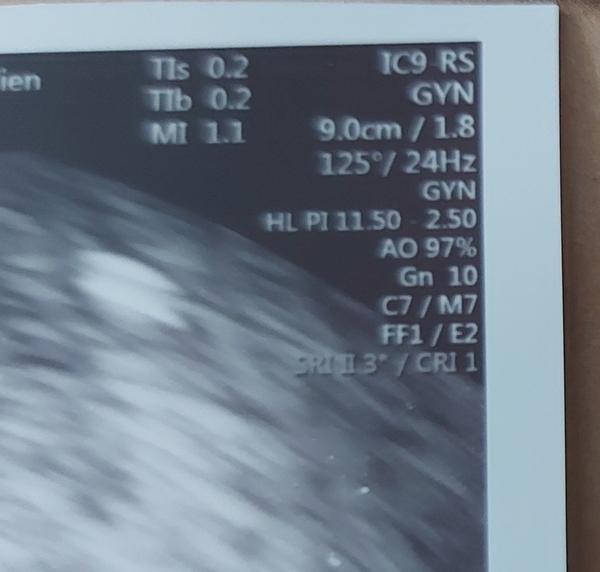 Skratky na ultrazvuku - 5. týždeň