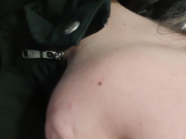 Aké to mám znamienko?