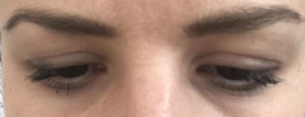 Padnuté očné viečka