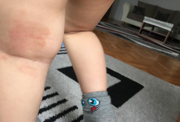 Čo znamenajú tieto fľaky?