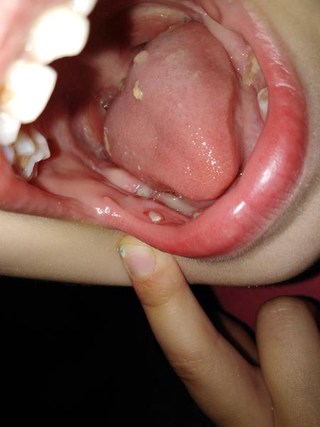 Aký pľuzgier to má dcérka v ústach?