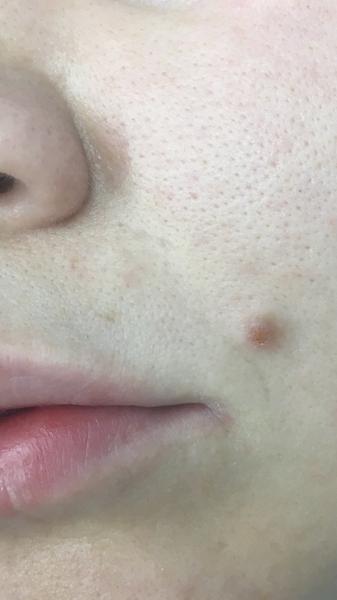 Čo to mám so znamienkom?