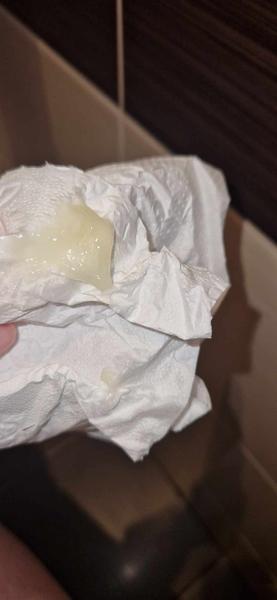 Je hlienová zátka v 39. týždni normálna?