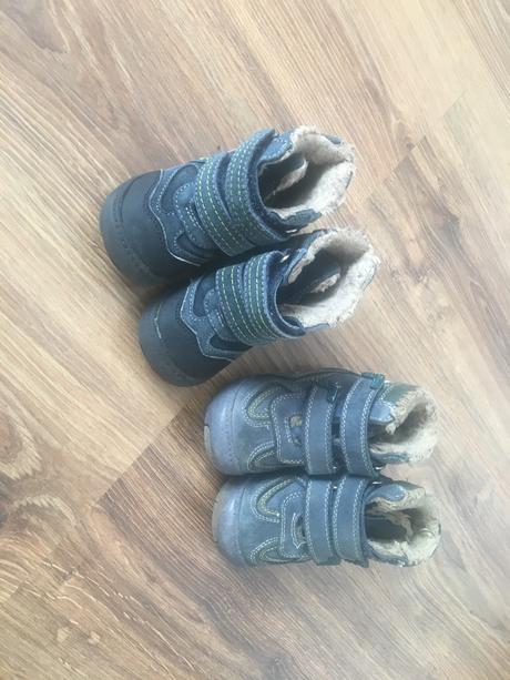 Čižmičky protetika, protetika,21