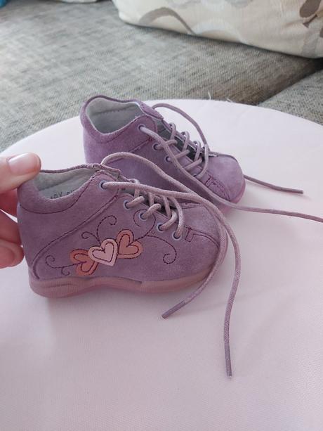 Protetika prve topanky vel.17, protetika,17