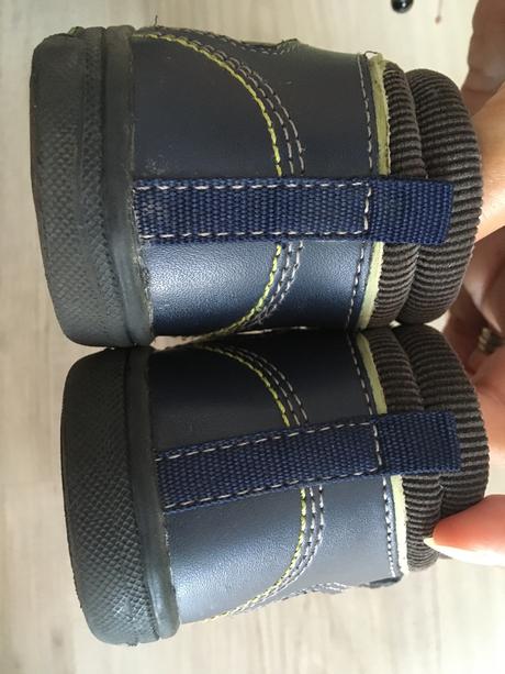 Topanocky protetika, protetika,23