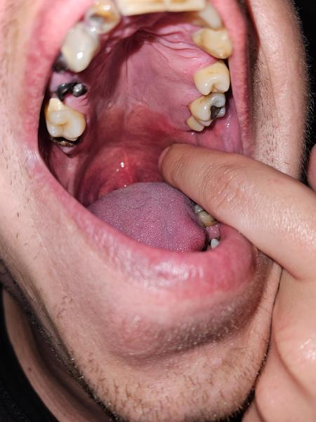 Viac ako dva týždne bolí hrdlo?