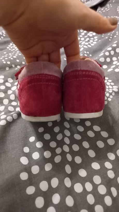 Sandálky protetika, protetika,30