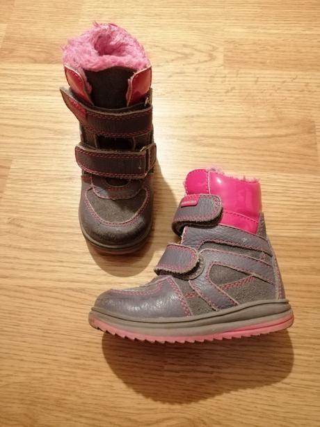 Topanky protetika, protetika,22