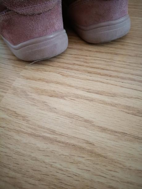 Protetika barefoot, protetika,31