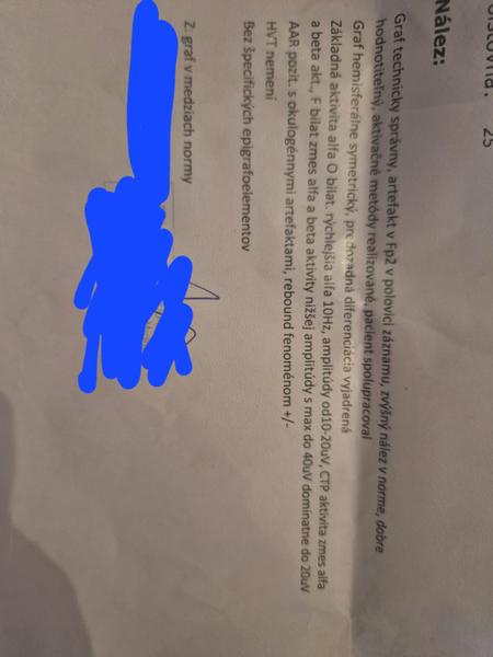 Je EEG vyšetrenie v poriadku?