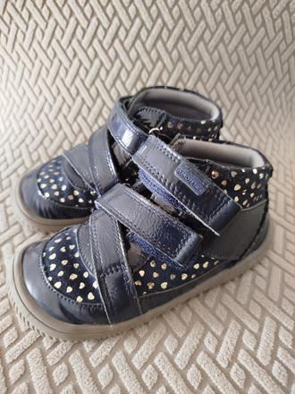 Protetika prechodné barefoot topánky, protetika,26