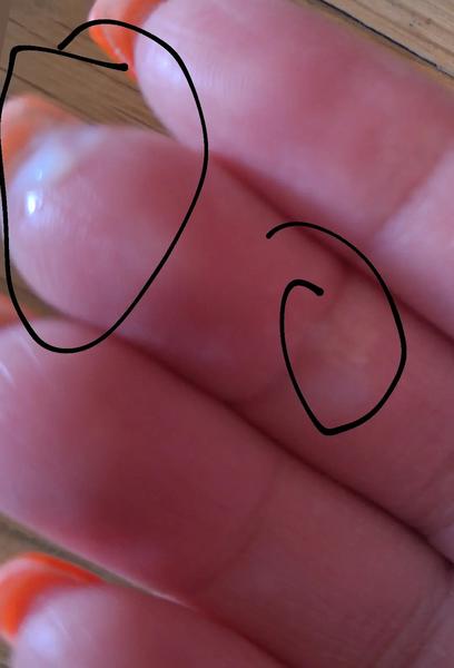 Biely výtok na 8. deň cyklu: Čo to znamená?