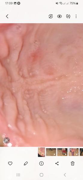 Čo spôsobuje červené miesto na podnebí?