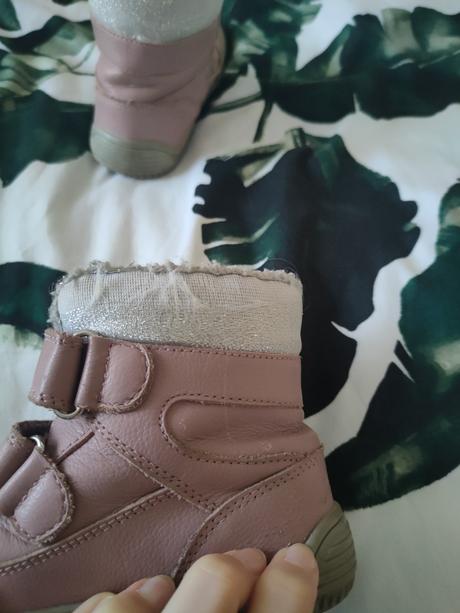 Čižmičky, protetika,25