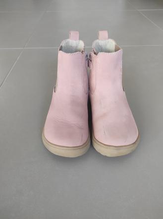 Prechodné topánky, protetika,31