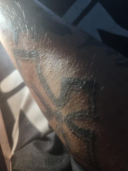 Ako liečiť vyrážky, ktoré pretrvávajú štyri dni?