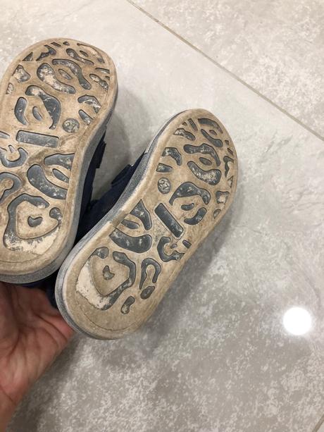 Protetika zateplene tenisky, protetika,27