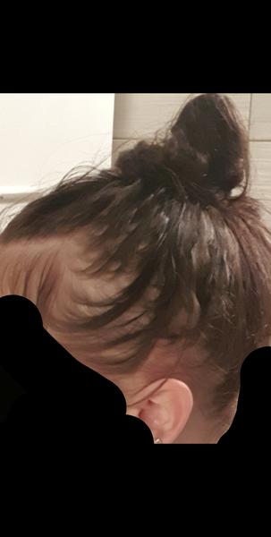 Začali mi vypadávať vlasy v nadmernom množstve