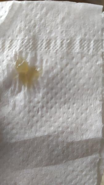 Výtok v 29. týždni