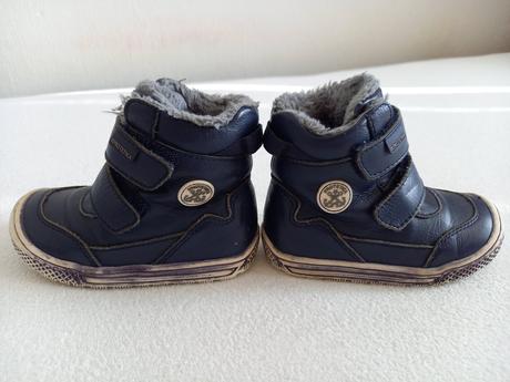 Čižmy protetika, protetika,22