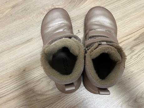 Zimne topanky, protetika,35