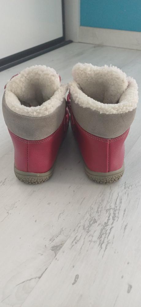 Zimné zateplené kožené topánky protetika vel.31, protetika,31