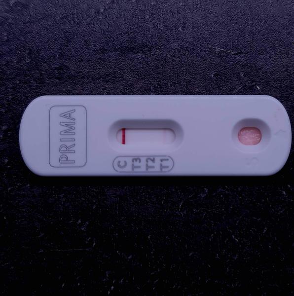 Antibiotiká pri tomto výsledku CRP testu