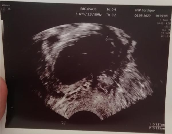 Čo znamenajú body 1 a 2 na snímke zo sona?