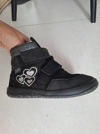 Topanocky jonap s membranou, jonap,30