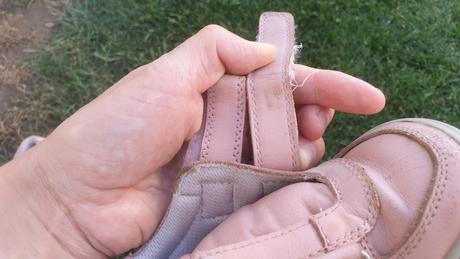 Topánky, tenisky a sandále, protetika,24