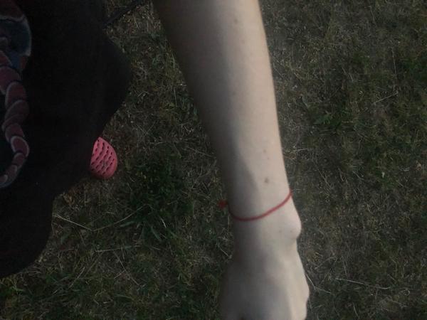 Z čoho môžu byť takéto žily?