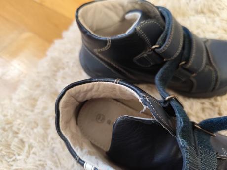 Členkové topánky, protetika,32