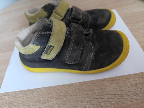 Barefoot protetika, protetika,31