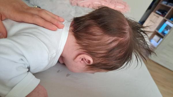 Má moje dieťa zležanú hlavičku?